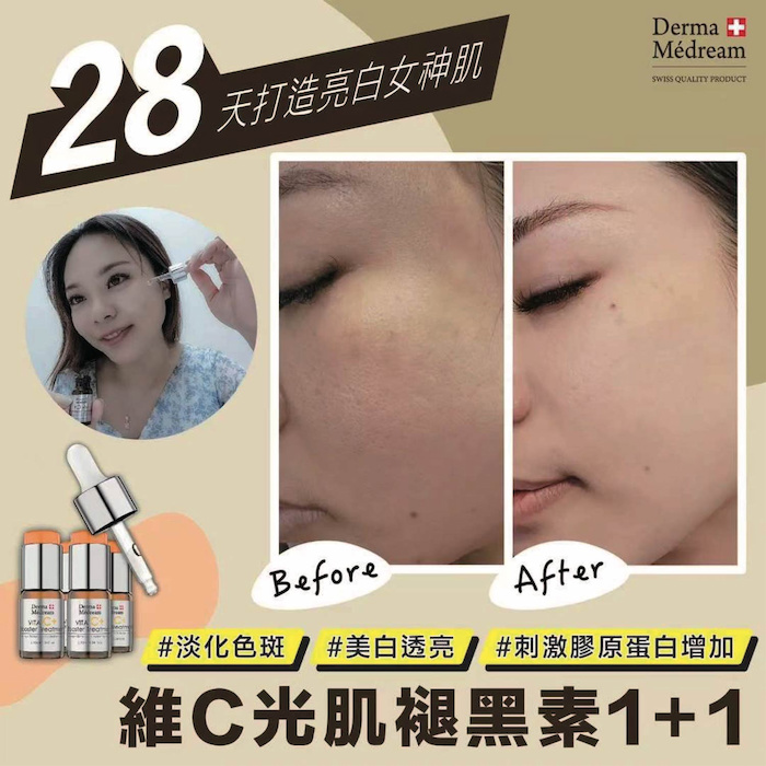 Derma Medream Vita C Booster Treatment Serum (Whitening, Acne Marks, Sensitive, Antioxidant, Pore Minimizing, Firming, Brightening) DM Fixed SizeProduct Thumbnail