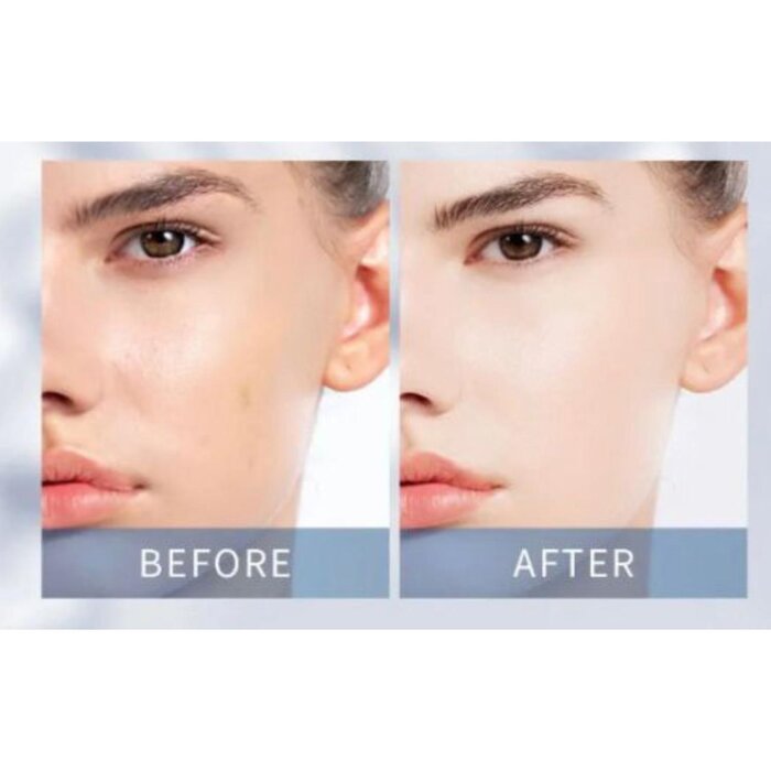 Perfect Healthy Beauty 3-Stage Botila Facial Treatment Picture ColorProduct Thumbnail