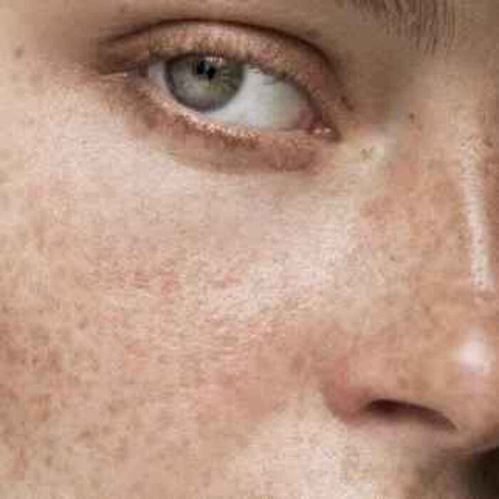 Blossom Blossom Pigment Perfecting Serum, Designed from the UK Fixed SizeProduct Thumbnail