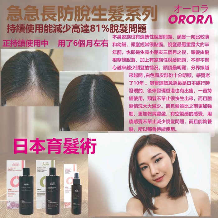 ORORA Extreme Length & Anti Hair Loss Shampoo 300ml Fixed alle